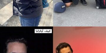 AbdelKader Dermas